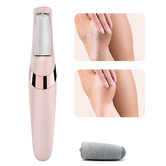 Electric Callus Remover for Feet – Rechargeable Pedicure Tool for Dead Skin & Cracked Heels Removal