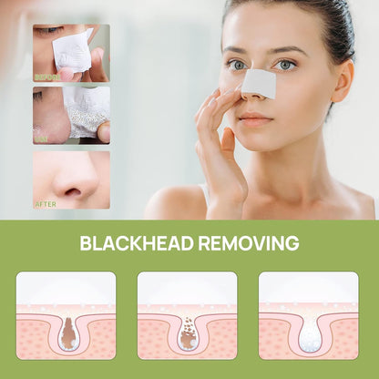 LANBENA 2% BHA Blackhead Removal Nose Mask – Deep Pore Cleansing Treatment