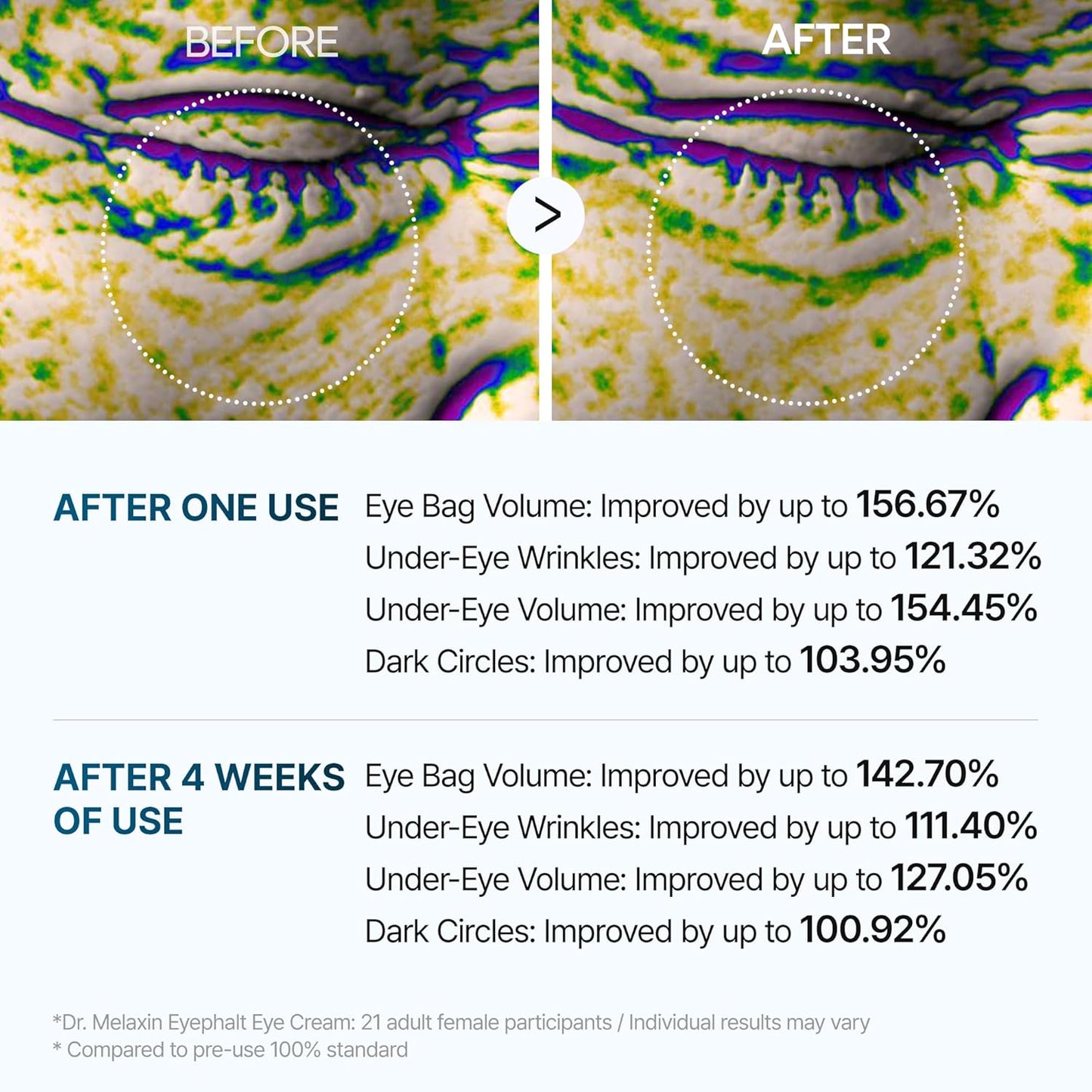 Dr. Melaxin Eyephalt Eye Bag Cream – Advanced Under Eye Treatment for Dark Circles, Puffiness & Wrinkles