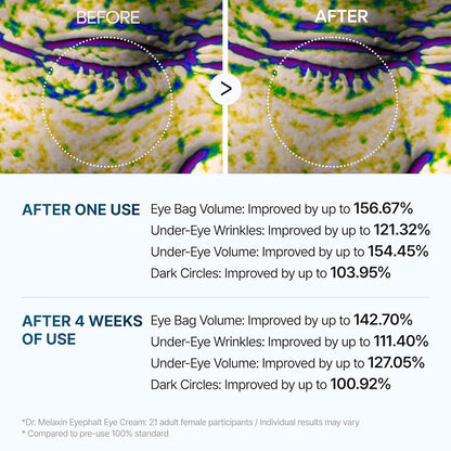 Dr. Melaxin Eyephalt Eye Bag Cream – Advanced Under Eye Treatment for Dark Circles, Puffiness & Wrinkles