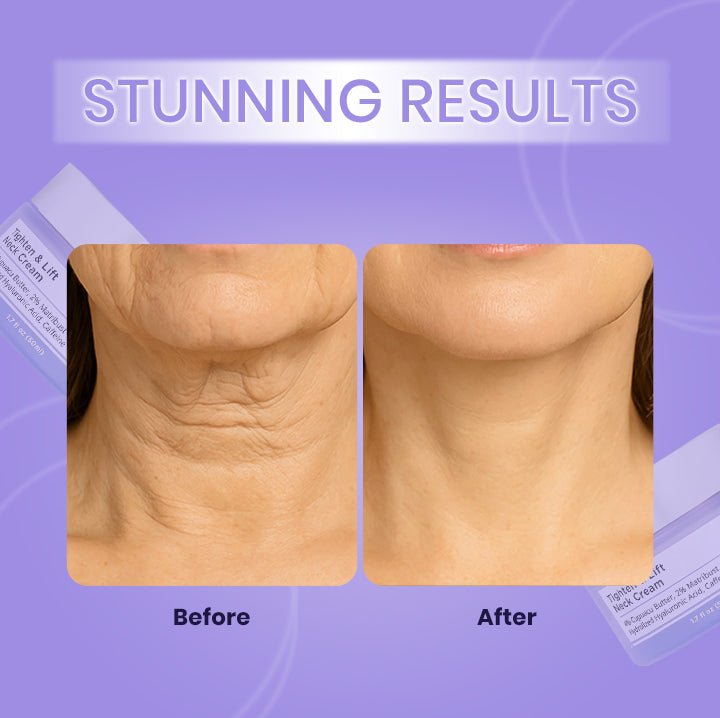 Tighten & Lift Neck Cream | Anti-Aging Neck Firming Cream - Ifrah Mart