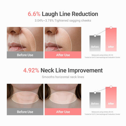 Wrinkle Bounce Multi Balm | Hydrating Anti-Wrinkle Face Balm - Ifrah Mart